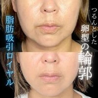 画像1475：施術事例