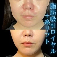 画像1477：施術事例