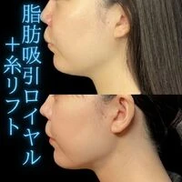 画像1479：施術事例