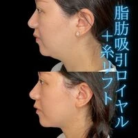 画像1481：施術事例