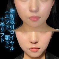 画像1487：施術事例