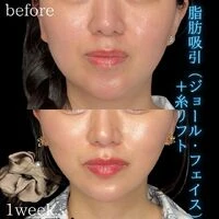 画像1489：施術事例