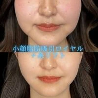 画像1495：施術事例