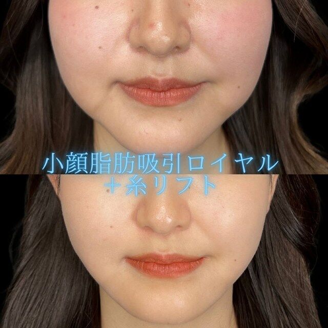 multi_image