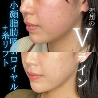 画像1499：施術事例