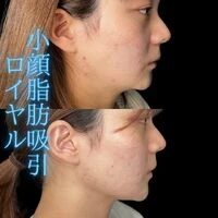 画像1501：施術事例