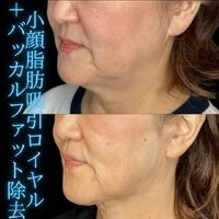 画像1503：施術事例