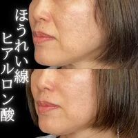 画像1509：施術事例
