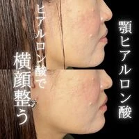 画像1517：施術事例