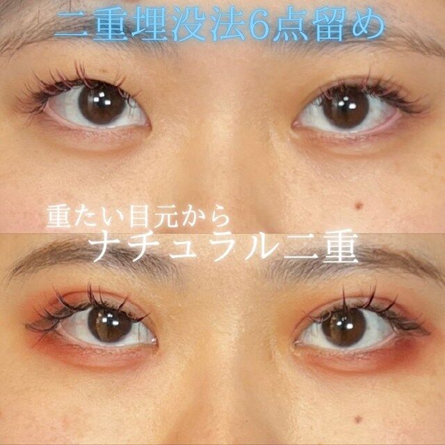 multi_image