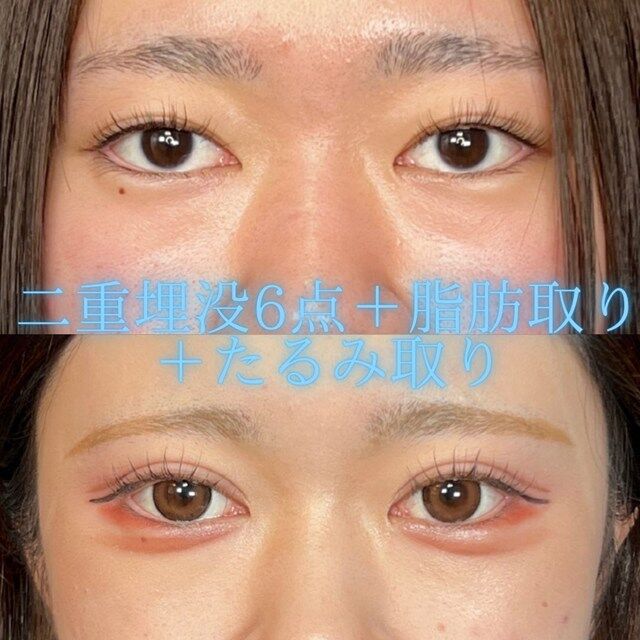 multi_image