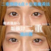 画像1527：施術事例
