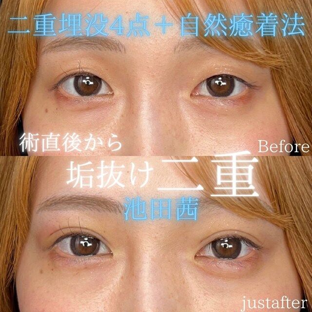 multi_image