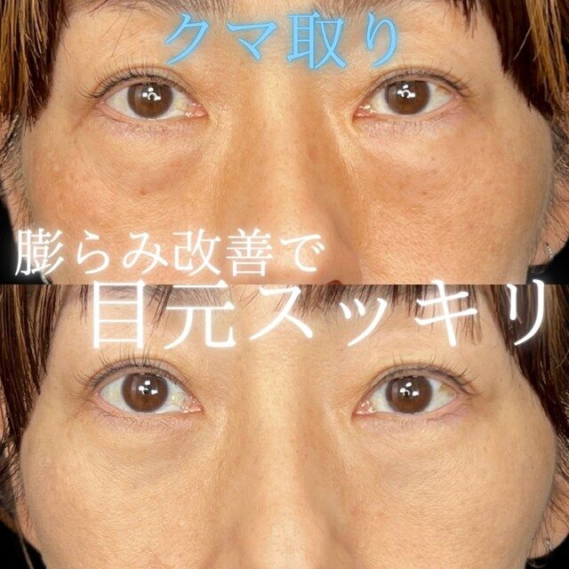 multi_image