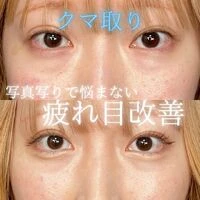 画像1531：施術事例