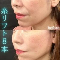 画像1535：施術事例