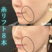 画像1537：施術事例