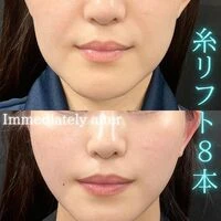 画像1539：施術事例