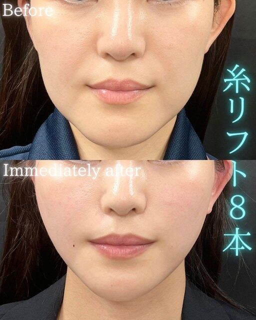 multi_image