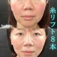 画像1541：施術事例