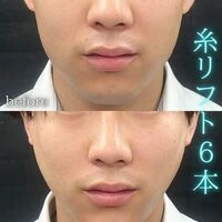 画像1543：施術事例