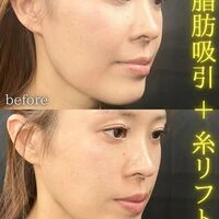 画像1545：施術事例