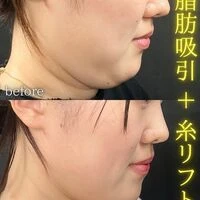 画像1547：施術事例