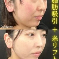 画像1549：施術事例