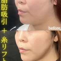 画像1551：施術事例