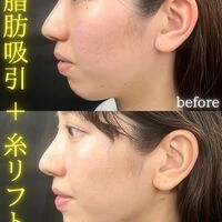 画像1553：施術事例