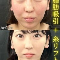 画像1555：施術事例
