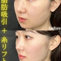 画像1557：施術事例