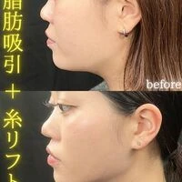 画像1559：施術事例