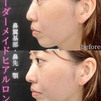 画像1561：施術事例