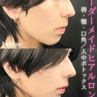 画像1563：施術事例