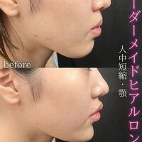 画像1569：施術事例