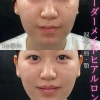 画像1571：施術事例