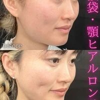 画像1573：施術事例