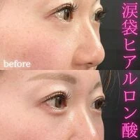 画像1575：施術事例