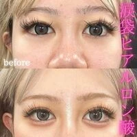 画像1577：施術事例