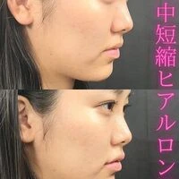 画像1579：施術事例