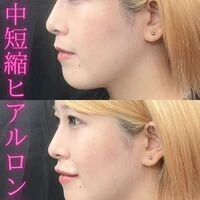 画像1581：施術事例