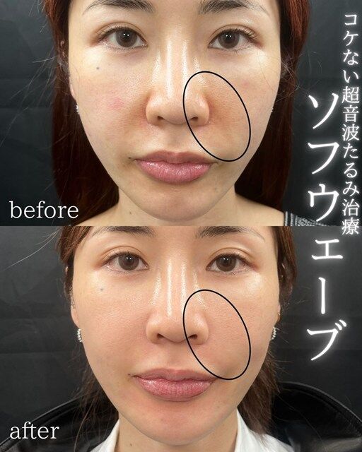 multi_image