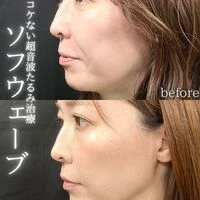画像1591：施術事例