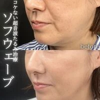 画像1593：施術事例
