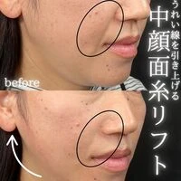 画像1597：施術事例