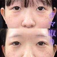 画像1599：施術事例