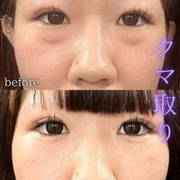 画像1601：施術事例