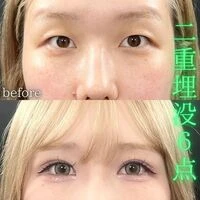画像1605：施術事例