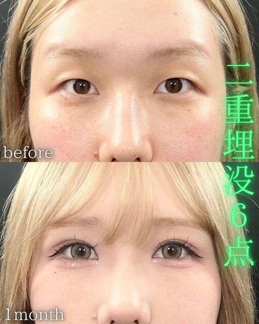 multi_image